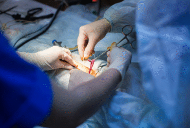 Laproscopy